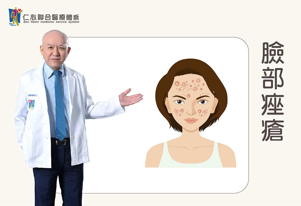青春痘(脸部痤疮)